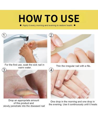 Tbeautfave Fungal Nail Treatment Nail Fungus Treatment for Toenail Ginseng Nail Treatment Essence Nail Growth Treatment Relief Oil Nail Repair Solution Toenail Oil Treatment Nail Care - Buy Online on GoSupps.com