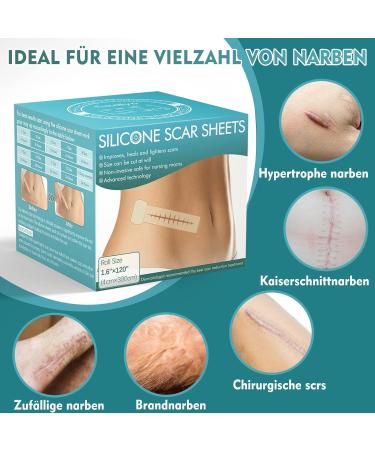 Silicone Scar Sheets Roll - Reusable Scar Removal Tape for Old & New Scars (1.6 x 120 inches) - Buy Online on GoSupps.com