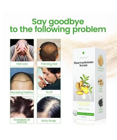 Premium Hair Growth Serum | Accelerate Hair Growth for Men & Women | Anti-Hair Failure & Thickening Formula - Buy Online on GoSupps.com