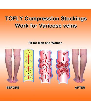 TOFLY Medical Compression Stockings 20-30 mmHg Knee High Socks | Closed-toe Black (Size S) - Buy Online on GoSupps.com