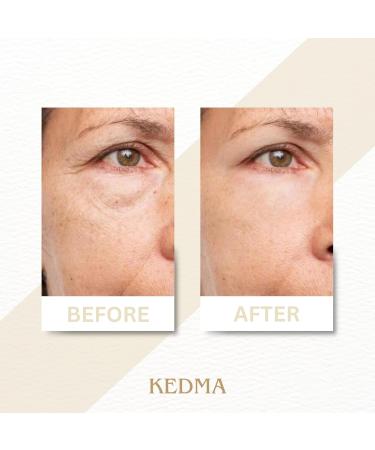 Kedma - Day and Night Cream Set with Collagen and Dead Sea Minerals - Moisturizing and Anti-Aging - 2x50g - Buy Online on GoSupps.com