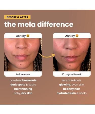 Mela Daily Glow for Healthy Melanin-Rich Skin & Textured Hair with Silica, Millet, Pumpkin Seed, Probiotics, Hyaluronic Acid & Vitamin D3 Vegan, Biotin-Free, Gluten & Soy-Free 60 Count - Buy Online on GoSupps.com
