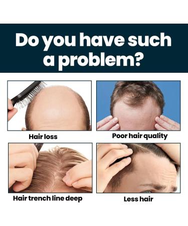 Serum Pousse Cheveux Anti Chute de Cheveux Homme Hair Growth Pousse Cheveux Tr s Rapide Favorise la Pousse des Cheveux Plus pais Hydrate Racines et R pare Cheveux Secs Fourchus et Cassants - Buy Online on GoSupps.com