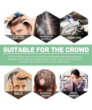 Renew Hair X Renew Hair X Roll-on Hair and Beard Regrow Hair Regrowth Treatment for Hair Loss Hair and Beard Regrowth Roll-on Serum for Men and Women (1 pc) - Buy Online on GoSupps.com