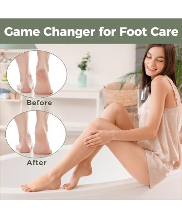 Easkeep Corneal Remover & Stainless Steel Corneal File | Hornhaut Trash Foot Gripper - Gray Green - Buy Online on GoSupps.com