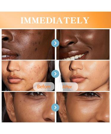 turmeric lotion for dark spots natural turmeric skin brightening cream face and body lotion soothing moisturizing lotion for glowing skin cream - Buy Online on GoSupps.com