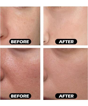 Facial Instant Moisturizing Essence Moisturizing Repair Firming Lifting Skin Moisturizing Essence 10ml - Buy Online on GoSupps.com