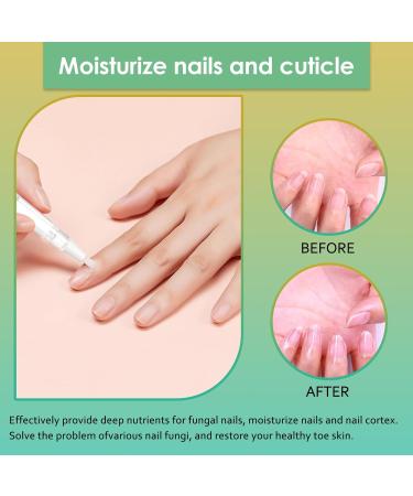 3-Piece Nail Care Pen Set - Fast Nail Fungus Treatment with Tea Tree Oil & Vitamin E for Healthy Fingernails & Toenails - Buy Online on GoSupps.com