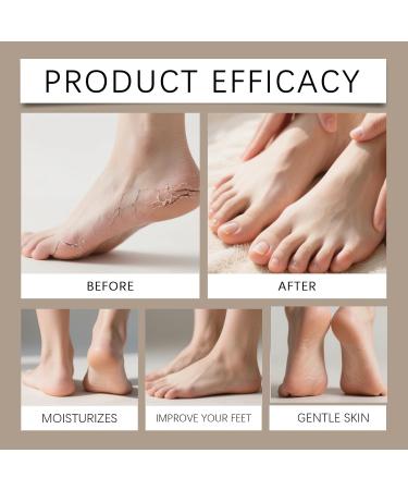  homomdy Repairing foot stick with 60% urea urea foot cream stick for chapped and dry skin callus removal for feet and hands deep moisturizing softens - Buy Online on GoSupps.com