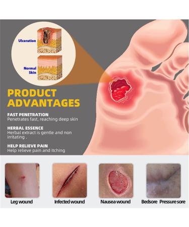 KXC Decubitus Treatment Cream 20g - Relief for Pressure Sores (4 pcs) - Buy Online on GoSupps.com
