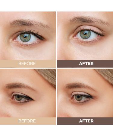Silkdermis Eyelid Tape - 400 Count Invisible Double Eyelid Lifter Strips for Hooded & Droopy Lids - Buy Online on GoSupps.com