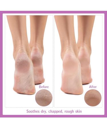 Dacitiery Moisturizing Socks - 3 Pairs Thin Cotton Foot Spa Socks for Dry Cracked Feet - Overnight Moisture Enhancing Solution - Buy Online on GoSupps.com