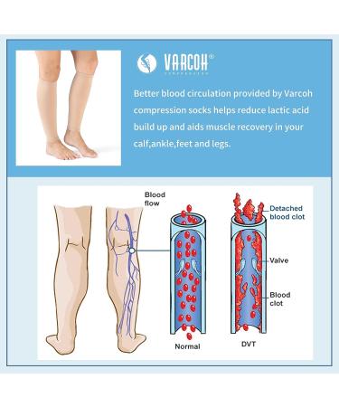 VARCOH Compression Socks (2 Pairs) 20-30mmHg Firm Support for Men & Women - Ideal for Varicose Veins, Swelling, Pregnancy, Recovery, Exercise - Large Beige - Buy Online on GoSupps.com