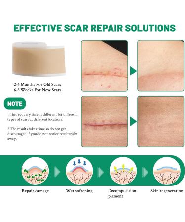 3 Rolls Silicone Scar Sheets(1.6" x 60" Each) Silicone Patches for Scars Reusable Scar Removal Strips for Prevention and Repair - Buy Online on GoSupps.com