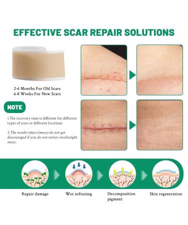 3 Rolls Silicone Scar Sheets - Reusable Scar Removal Strips for Prevention & Repair | Light Brown Silicone Scar Tape - Buy Online on GoSupps.com