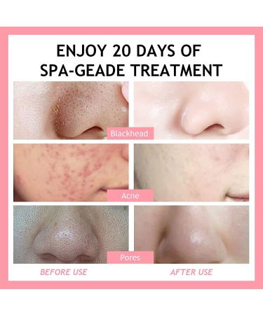 Strawberry Pink Clay Face Mask - Deep Cleansing, Acne Control, Oil Balance - 4.2 OZ - Buy Online on GoSupps.com