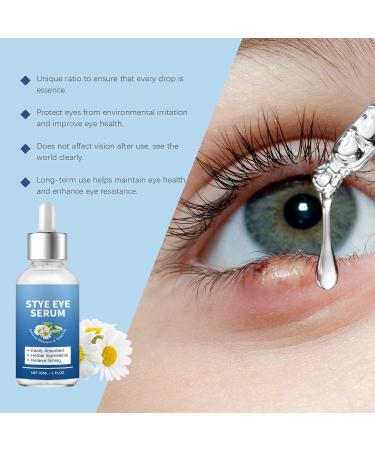 Stye Eye Treatment & Chalazion Remover | Eye Relief Serum & Gentle Lash Cleanser - Fast International Shipping - Buy Online on GoSupps.com