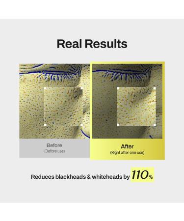 Niacin X BHA Pore Mild Clear Toner Pad - Korean Toner Pads for Face - Hydrating Face Toner for Pore Minimizer - Exfoliating Pore Care with Dual-Sided Pads - Gentle Blackhead Remover 60 Pads - Buy Online on GoSupps.com