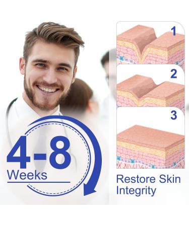 Yissone 1.6x120 Reusable Silicone Scar Sheets - for Softening and Flattening Scars - Silicone Scar Tape Roll - Buy Online on GoSupps.com