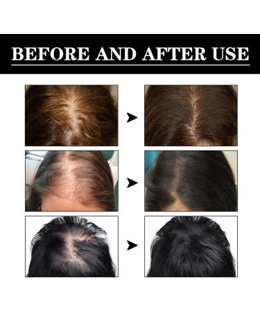 Noor Hair Growth Serum African Olive Noor Love Hair Essence Nourishing Miracle Treatment - Buy Online on GoSupps.com