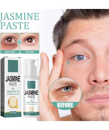  Orgrul Jasmine ointment dark circles under the eyes jasmine cream cream for under-eye bags active jasmine ointment eye cream for wrinkles and dark circles eye cream with - Buy Online on GoSupps.com