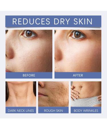 2 Pcs Skin Care Lotion Restore Skin Elasticity Coolord Luxelift Skin Firming Youth Butter Skin Tightening Cellulite Body Lotion Firming Cream for Loose Sagging Skin - Buy Online on GoSupps.com