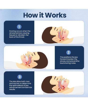 Anti Snoring Mouthpiece - Comfort Size Snoring Solution for Better Sleep | Adjustable for Men/Women - Buy Online on GoSupps.com
