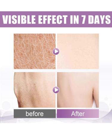 Exfoliating Face Wash Rose Body Exfoliator Smoothing Face Scrub Exfoliator for Large Pore & Acne Hydrating Exfoliating Face Scrub Body Acne & Rough Skin Bath Scrub Body Back & Arm & Knee-Women & Men - Buy Online on GoSupps.com