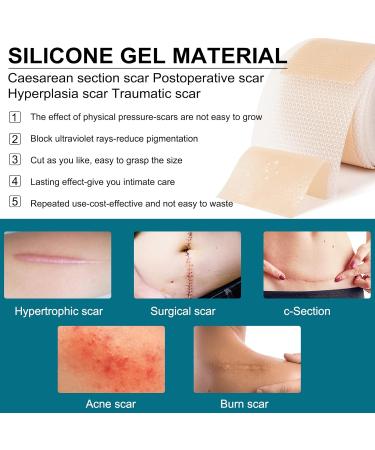 Silicone Scar Treatment Rollers - Heal C-Section Burns Keloids & Acne | 4cm x 320cm | Free Shipping Worldwide - Buy Online on GoSupps.com