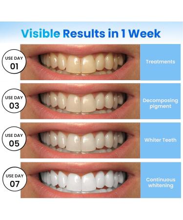 Teeth Whitening Kit Teeth Whitening Strips Teeth Whitening-14 Sessions 28 Strips Teeth Whitening Patch - Remove Deep Stains Safe and Suitable for Sensitive Teeth - Buy Online on GoSupps.com