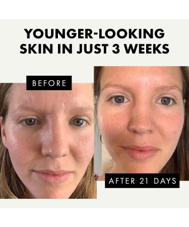 Eclat Skincare Collagen Boosting Overnight Mask - Anti Aging, Plumping, Reduces Wrinkles - Hyaluronic Acid & Niacinamide - Vegan - 3.4 oz - Buy Online on GoSupps.com