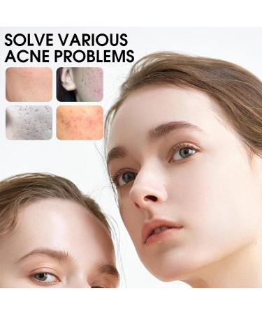 Lot de 432 patchs anti-boutons avec huile d'arbre th et acide salicylique - Buy Online on GoSupps.com