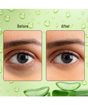 Swiss Beauty Hydra Anti-Wrinkle Eye Serum Patches - Dark Circles Treatment Fine Lines & Wrinkles Relief - Collagen & Aloe Vera Enriched - 60 Pcs - Buy Online on GoSupps.com