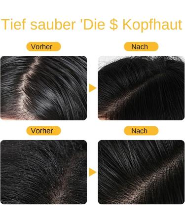  Zankie Grey Hair Reverse Bar Natural Soap to Remove Grey Hair | Grey Reverse Shampoo Bar | Men's White Hair Covering Shampoo Bar Lightening Shampoo Bar | - Buy Online on GoSupps.com