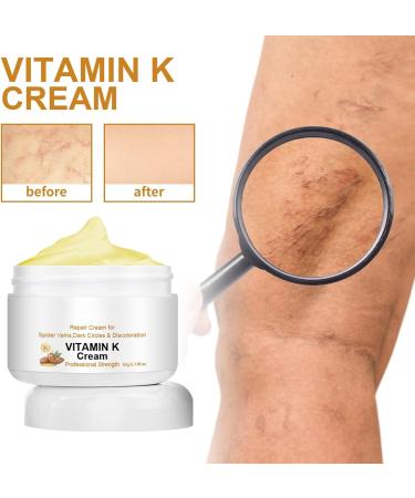 Vitamin K cream miracle varicose veins cream for legs varicose veins relief and restoration cream for legs cream serum for eliminating varicose veins moisturizing and - Buy Online on GoSupps.com