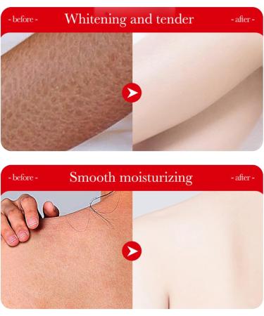 Crsetmyth Kojic Kojic Acid Skin Whitening Body Lotion 250 G Skin Whitening Cream Brightening Body Lotion with Kojic Acid Skin Lightening Body Cream for Radiant Skin - Buy Online on GoSupps.com
