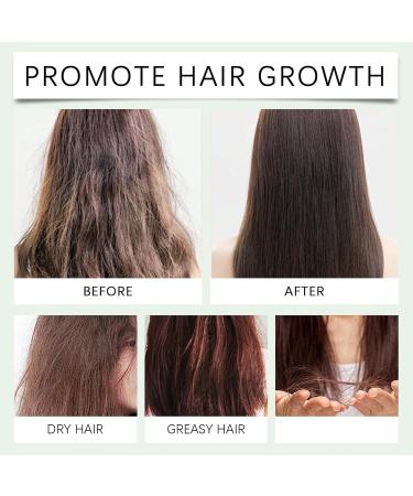 Fluffy Oil Control Shampoo Fluffy Oil Control Leave-In Shampoo Fluffy Oil Control Leave-In Shampoo Oil Control Leave-In Shampoo (5 Pcs) - Buy Online on GoSupps.com