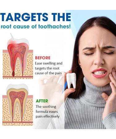 2PCS Toothache Relieving Spray Oral Care Spray Toothache Pain Relief for Adult for Teeth Health Instant Tooth Pain Relief Spray for Toothache Pain Spray for Toothache Relief Sore Gums Treatment - Buy Online on GoSupps.com