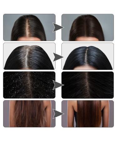 Darka Anti-Graying Hair Serum | 3pcs Ganoderma Nutrient Formula for Hair Growth & Eyebrow Care | Natural Anti-Gray Solution - Buy Online on GoSupps.com