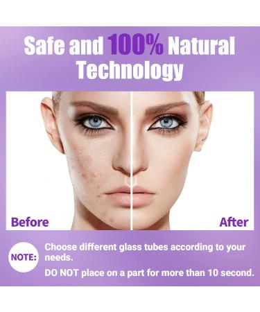 UUPAS Portable High Frequency Facial Machine - Handheld Facial Wand - Buy Online on GoSupps.com