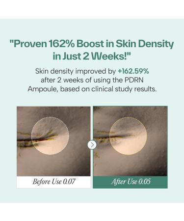 PDRN 73 Serum 730000ppm Plant-Based Kbeauty with Bakuchiol and Fast Absorption | Korean Facial Serum for Women Personal Care Niacinamide Hyaluronic Acid Glutathione (1.01 fl.oz) - Buy Online on GoSupps.com