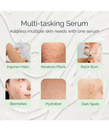 Serious Serum Vegan Ingrown Hair Serum & Aftershave - BHAs and AHAs for Razor Bumps & Burn - Buy Online on GoSupps.com
