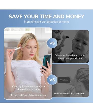 ScopeAround Otoscope for iPhone - 3.9mm Ultra-Thin Ear Camera with 6 LED Lights - Ear Wax Removal Kit - Specula Protection - Compatible with iPhone/Android - No WiFi Needed - Buy Online on GoSupps.com