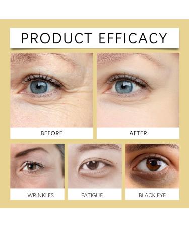 futiu Elastic Moisturizing Tightener Eye Cream - Enhances Eye Area Firmness Improves Wrinkles Easy Application Gentle Massage(5pcs) - Buy Online on GoSupps.com