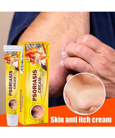 Anti Itching Cream Extra Strong Intensive Moisturizing Cream Natural Body Lotion 20g Soothes Nourishes Redness Itchy Skin for Adults and Children - Buy Online on GoSupps.com