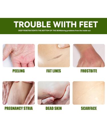 42% Urea Cream with 2% Salicylic Acid Urea Hand Cream for Dry Cracked Skin Repairs Rough Feet & Hands Moisturizes with Coconut & Aloe 50g - Buy Online on GoSupps.com