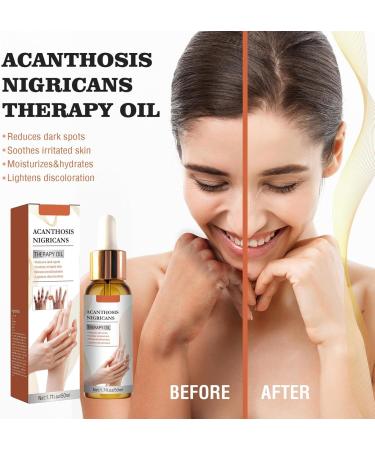 Dark Spot serrum Skin Lightening serrum Cruelty Facial serrum Black Spot Lightening serrums Dark Spot Remover serrum treatmnt For Face Skin Bleaching serrums For Armpit Areas - Buy Online on GoSupps.com