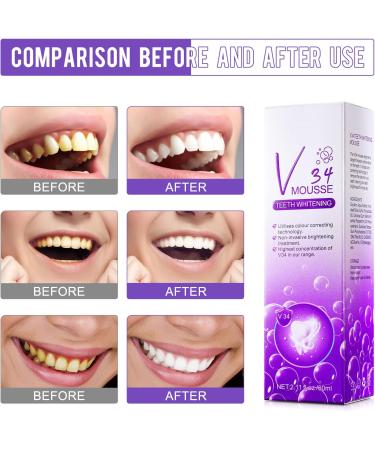 V34 Teeth Whitening Mousse - 1 Fl Oz - Purple Foam Toothpaste for Stain Removal & Brightening - Buy Online on GoSupps.com