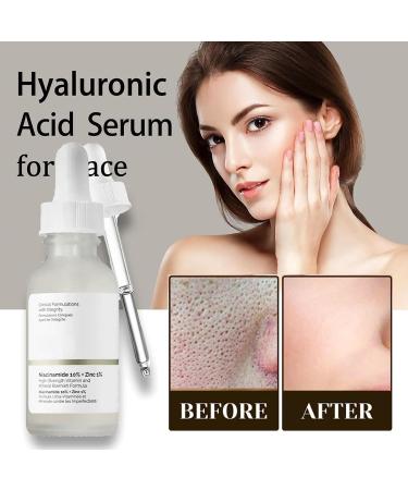 Niacinamide10%+Zinc 1% & Hyaluronic Acid 2% + B5 Skincare Serum Face Serum for Women & Men Face Moisturizer Set Dark Spot Remover for Face Lightweight Face Serum Tackles Blemishes Minimises Pore - Buy Online on GoSupps.com