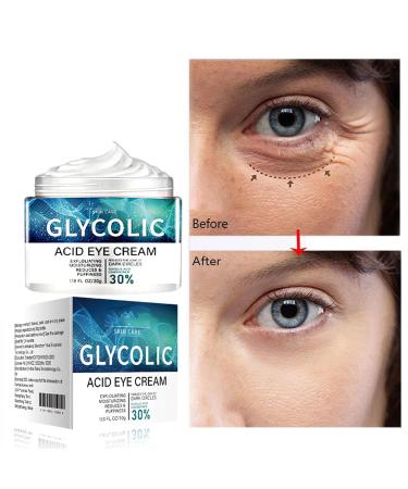 Buy Glycolic Acid Eye Cream 30g - Anti Wrinkle Hydrating Reduces Dark Circles & Puffiness - Buy Online on GoSupps.com
